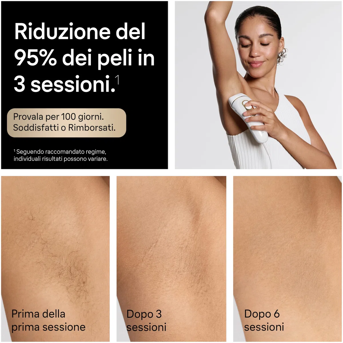 Braun Silk·Expert Pro 5, Epilatore Luce Pulsata Smart, Epilazione Laser Peli Donna a Casa, Riduzione Permanente dei Peli, con 3 Testine, Custodia e Rasoio Gillette Venus, Pl5321